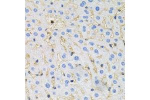 Immunohistochemistry of paraffin-embedded mouse liver using Tau antibody (ABIN3021441, ABIN3021442, ABIN3021443 and ABIN6215045) at dilution of 1:100 (40x lens). (MAPT Antikörper  (AA 1-100))