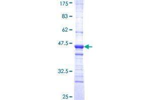 SPDEF/PSE Protein (AA 92-200) (GST tag)