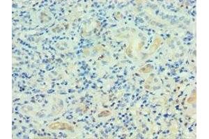 Immunohistochemistry of paraffin-embedded human kidney tissue using ABIN7164230 at dilution of 1:100