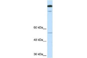 TIMELESS antibody used at 1. (TIMELESS Antikörper  (N-Term))