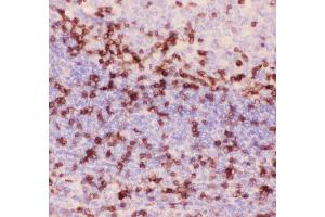 Immunohistochemistry (IHC) image for anti-CD3 epsilon (CD3E) (AA 23-207) antibody (ABIN3043805)