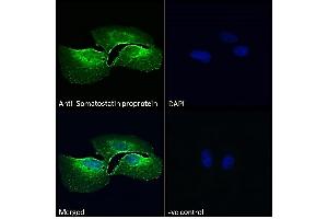 ABIN7013881 Immunofluorescence analysis of paraformaldehyde fixed U2OS cells, permeabilized with 0. (Somatostatin Antikörper  (AA 58-70))