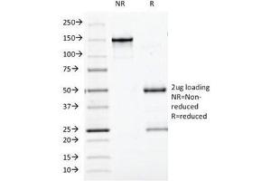 SDS-PAGE Analysis of Purified, BSA-Free Bcl10 Antibody (clone BL10/411). (BCL10 Antikörper  (AA 122-168))