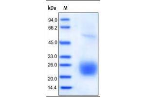 SDS-PAGE (SDS) image for Cytotoxic T-Lymphocyte-Associated Protein 4 (CTLA4) (AA 37-162) (Active) protein (His tag) (ABIN2487344)