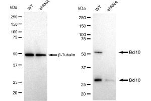 Western blotting analysis using Bcl10 antibody (ABIN7797717). (Rekombinanter BCL10 Antikörper)