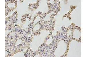 Immunohistochemistry (IHC) image for anti-Calcium/calmodulin-Dependent Protein Kinase IV (CAMK4) antibody (ABIN1876492) (CAMK4 Antikörper)