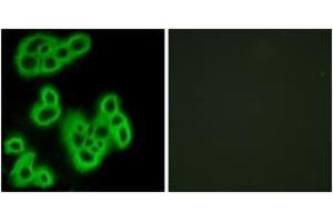 Immunofluorescence analysis of MCF7 cells, using FPR1 Antibody. (FPR1 Antikörper  (AA 155-204))