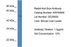 Western Blotting (WB) image for anti-Sushi-Repeat Containing Protein, X-Linked (SRPX) (C-Term) antibody (ABIN786020) (SRPX Antikörper  (C-Term))