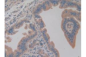 Immunohistochemistry (IHC) image for anti-Aminoacyl tRNA Synthetase Complex-Interacting Multifunctional Protein 1 (AIMP1) (AA 2-310) antibody (ABIN7430078)