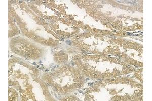 ABIN6260524 and ABIN6272568 at 1/100 staining human normal kidney tissue by IHC-P.