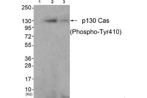 Western blot analysis of extracts from K562 cells (Lane 2) and 3T3 cells (Lane 3), using P130 Cas(Phospho-Tyr410) Antibody. (BCAR1 Antikörper  (pTyr410))
