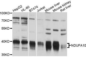 Western blot analysis of extracts of various cell lines, using NDUFA10 antibody (ABIN6003821) at 1/1000 dilution. (NDUFA10 Antikörper)
