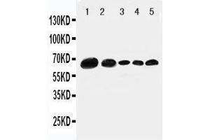 Anti-Paxillin antibody, Western blotting Lane 1: 293T Cell Lysate Lane 2: HELA Cell Lysate Lane 3: MCF-7 Cell Lysate Lane 4: MM231 Cell Lysate Lane 5: JUKAT Cell Lysate (Paxillin Antikörper  (C-Term))