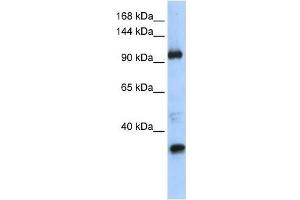 Western Blot showing TUT1 antibody used at a concentration of 1-2 ug/ml to detect its target protein. (TUT1 Antikörper  (Middle Region))