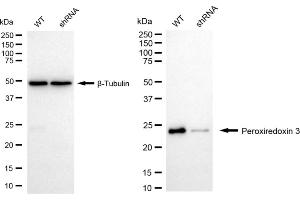 Western blotting analysis using Peroxiredoxin 3 antibody (ABIN7799778). (Rekombinanter Peroxiredoxin 3 Antikörper)