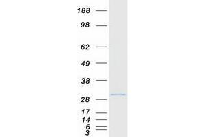 Validation with Western Blot