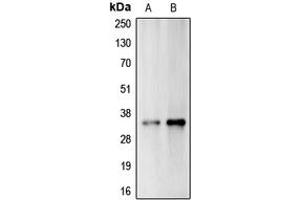 Western blot analysis of Carbonic Anhydrase 14 expression in A375 (A), Jurkat (B) whole cell lysates. (CA14 Antikörper  (Center))