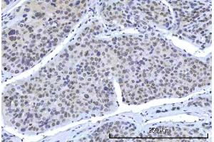 IHC analysis of RBM15B using anti-RBM15B antibody (ABIN7600219).