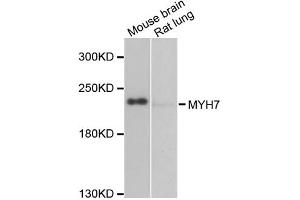Western blot analysis of extracts of various cell lines, using MYH7 antibody (ABIN2563999) at 1:1000 dilution. (MYH7 Antikörper)