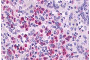 Immunohistochemistry (IHC) image for anti-Pyrimidinergic Receptor P2Y, G-Protein Coupled, 4 (P2RY4) (Extracellular Domain) antibody (ABIN1049219)