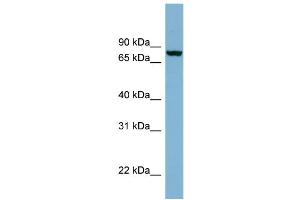 WB Suggested Anti-NCDN Antibody Titration: 0. (NCDN Antikörper  (N-Term))