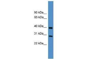 WB Suggested Anti-TIMP2 Antibody Titration: 0. (TIMP2 Antikörper  (Middle Region))
