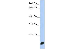 WB Suggested Anti-DSTN Antibody Titration:  0.