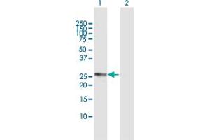 Western Blot analysis of CIDEA expression in transfected 293T cell line by CIDEA MaxPab polyclonal antibody. (CIDEA Antikörper  (AA 1-253))