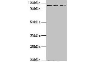 Western blot All lanes: MERTK antibody at 10 μg/mL Lane 1: Mouse gonad tissue Lane 2: Mouse lung tissue Lane 3: Mouse kidney tissue Secondary Goat polyclonal to rabbit IgG at 1/10000 dilution Predicted band size: 110 kDa Observed band size: 110 kDa (MERTK Antikörper  (AA 840-999))
