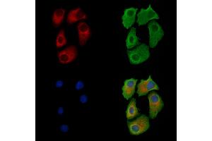 anti-Golgi Brefeldin A Resistant Guanine Nucleotide Exchange Factor 1 (GBF1) antibody