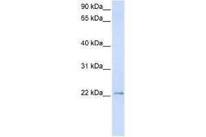 TMEM9 antibody used at 1 ug/ml to detect target protein.