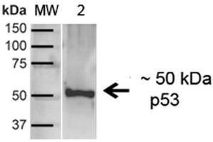 Western blot analysis of Human A431 showing detection of ~43. (p53 Antikörper  (C-Term) (FITC))