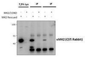 Immunoprecipitation (IP) image for anti-Mitogen-Activated Protein Kinase-Activated Protein Kinase 2 (MAPKAPK2) antibody (ABIN5903087) (MAPKAP Kinase 2 Antikörper)