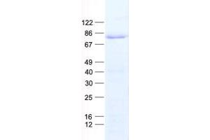 Western Blotting (WB) image for Transcription Factor 3 (E2A Immunoglobulin Enhancer Binding Factors E12/E47) (TCF3) protein (His tag) (ABIN2733359)