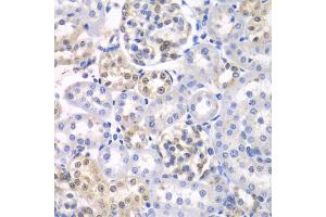 Immunohistochemistry of paraffin-embedded rat kidney using HDAC2 antibody. (HDAC2 Antikörper)