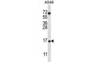 Western Blotting (WB) image for anti-Cytochrome C Oxidase Subunit VIIa Polypeptide 2 Like (COX7A2L) antibody (ABIN2996672) (COX7A2L Antikörper)