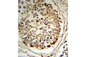 TPA Antibody (RB18787) IHC analysis in formalin fixed and paraffin embedded human testis tissue followed by peroxidase conjugation of the secondary antibody and DAB staining. (PLAT Antikörper  (AA 371-399))