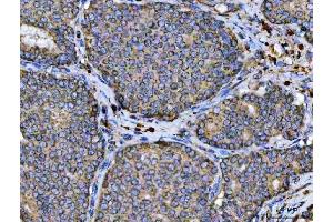 IHC analysis of ARL13B using anti-ARL13B antibody (ABIN7600179). (ARL13B Antikörper  (AA 16-428))