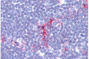 Human Thymus (formalin-fixed, paraffin-embedded) stained with CD1A antibody ABIN462117 at 1:100-1:200 followed by biotinylated goat anti-rabbit IgG secondary antibody ABIN481713, alkaline phosphatase-streptavidin and chromogen. (CD1a Antikörper)