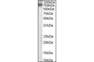 Image no. 1 for anti-Receptor Protein Tyrosine Phosphatase (PTPRT) (Internal Region) antibody (ABIN372866) (PTPRT Antikörper  (Internal Region))