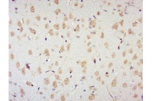Immunohistochemistry (Paraffin-embedded Sections) (IHC (p)) image for anti-Ribosomal Protein S6 Kinase, 70kDa, Polypeptide 2 (RPS6KB2) (pSer447), (pThr444) antibody (ABIN702850)