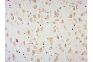 Paraformaldehyde-fixed, paraffin embedded rat brain, Antigen retrieval by boiling in sodium citrate buffer (pH6) for 15min, Block endogenous peroxidase by 3% hydrogen peroxide for 30 minutes, Blocking buffer (normal goat serum) at 37°C for 20min, Antibody incubation with p70 S6 Kinase Beta (Thr444 + Ser447) Antibody, Unconjugated  at 1:400 overnight at 4°C, followed by a conjugated secondary and DAB staining. (RPS6KB2 Antikörper  (pSer447, pThr444))