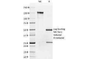SDS-PAGE AnalysisPurified CD35 Mouse Monoclonal Antibody (To5). (CD35 Antikörper)