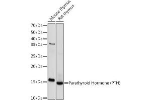 Western blot analysis of extracts of various cell lines, using Parathyroid Hormone (PTH) (PTH) Rabbit mAb (ABIN7269175) at 1:1000 dilution. (PTH Antikörper)