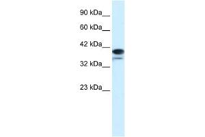 WB Suggested Anti-PAntibody Titration:  1. (PARP6 Antikörper  (N-Term))