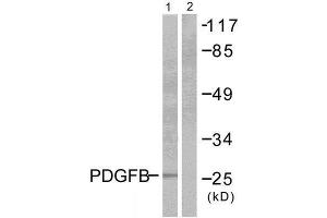 Western Blotting (WB) image for anti-Platelet Derived Growth Factor Subunit B (PDGFB) (Internal Region) antibody (ABIN1848736) (PDGFB Antikörper  (Internal Region))
