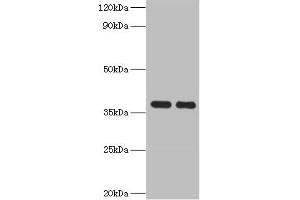 Western blot All lanes: GALM antibody at 2 μg/mL Lane 1: Mouse kidney tissue Lane 2: Rat adrenal gland tissue Secondary Goat polyclonal to rabbit IgG at 1/10000 dilution Predicted band size: 38 kDa Observed band size: 38 kDa (GALM Antikörper  (AA 2-342))