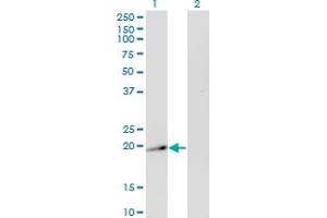 Western Blot analysis of TWIST2 expression in transfected 293T cell line by TWIST2 monoclonal antibody (M20A), clone 3B2. (TWIST2 Antikörper  (AA 54-140))