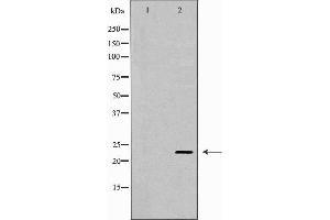 Western blot analysis of extracts of Mouse muscle, using CNTF antibody. (CNTF Antikörper  (C-Term))