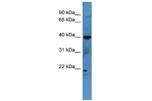WB Suggested Anti-MRGPRX3 Antibody Titration: 0.
